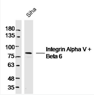 Integrin Alpha V/Beta 6 antibody