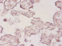 HMGCR Antibody