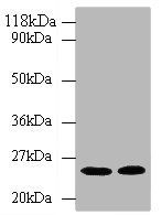 3-hydroxy-3 methylglutaryl-coenzyme A reductase antibody