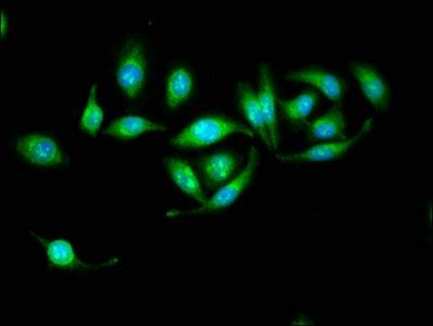 3-hydroxyacyl-CoA dehydrogenase type-2 antibody