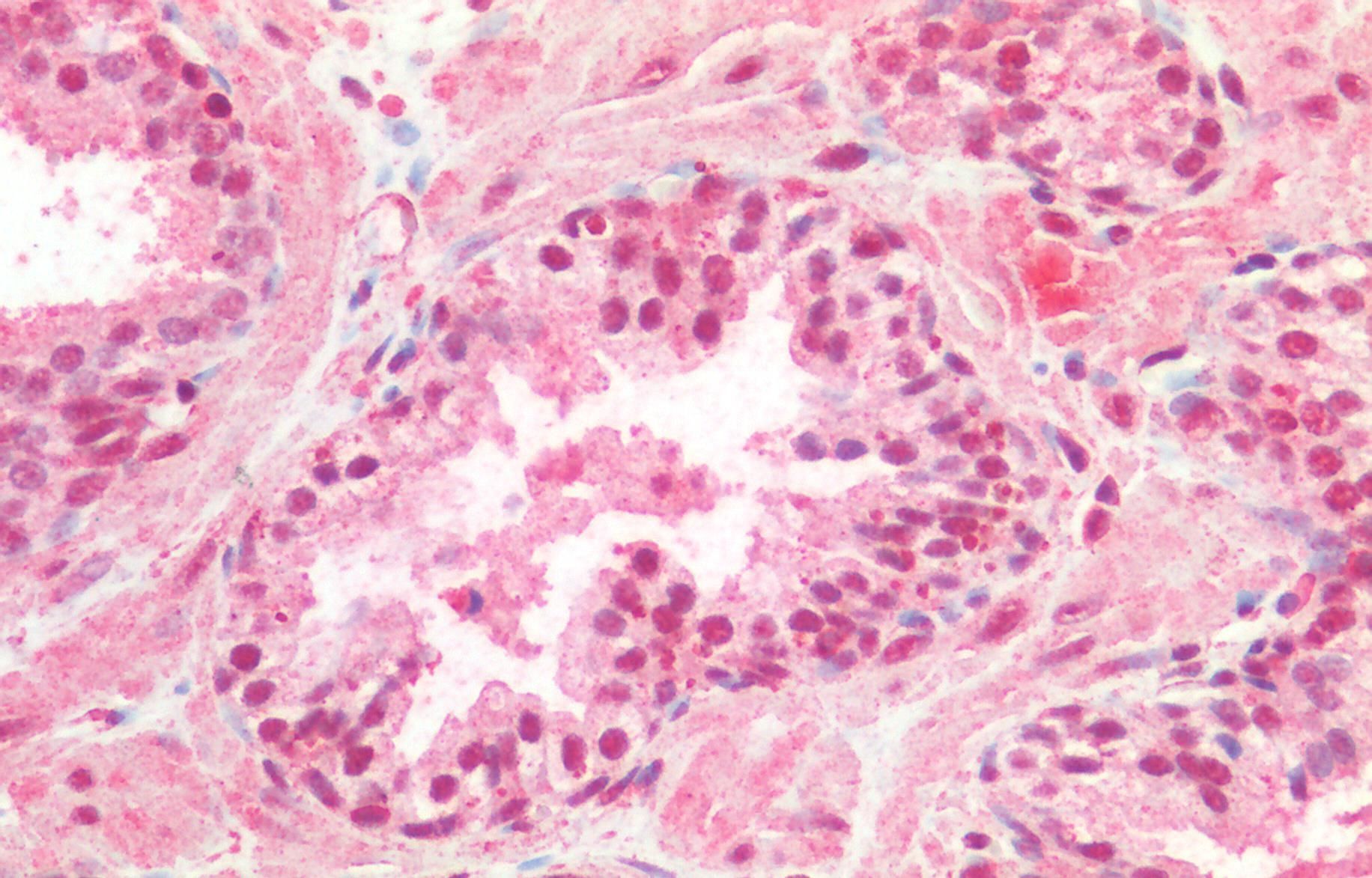 Goat anti-CREB1 (aa96-109) Antibody