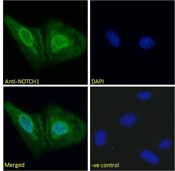 NOTCH1 (aa171-182) Antibody