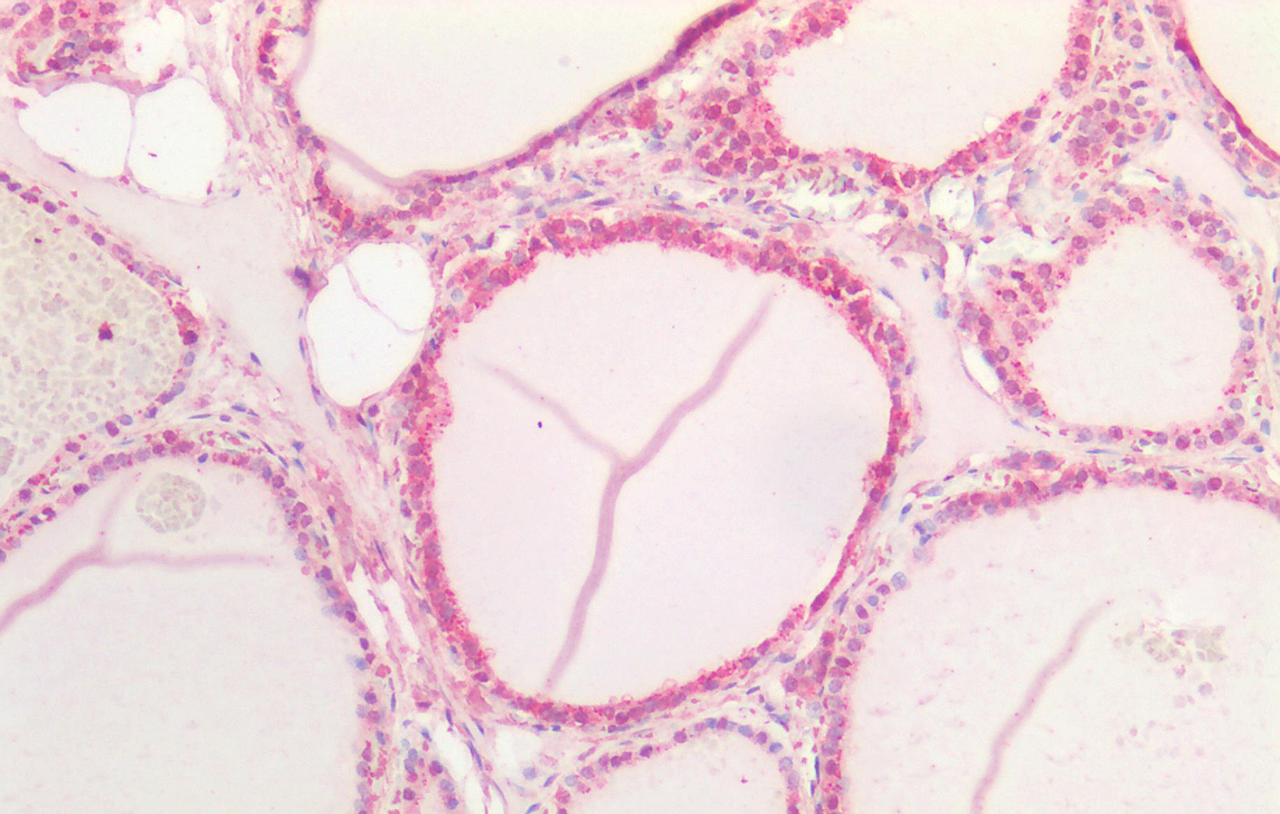 NOTCH1 antibody