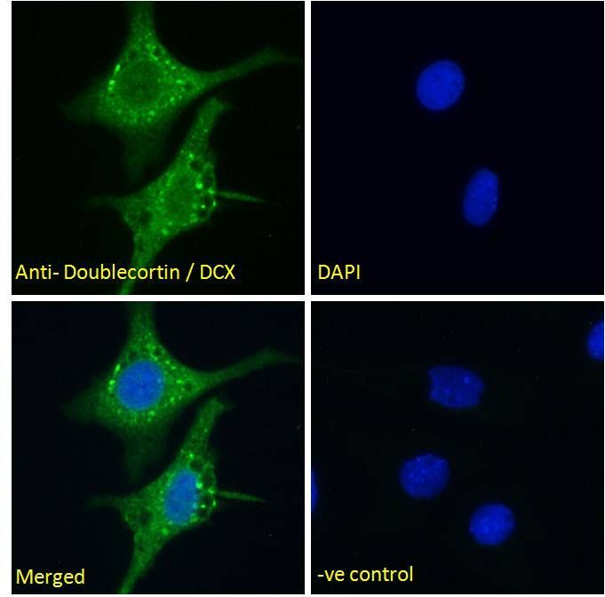 Goat anti-Doublecortin / DCX (aa69-81) Antibody