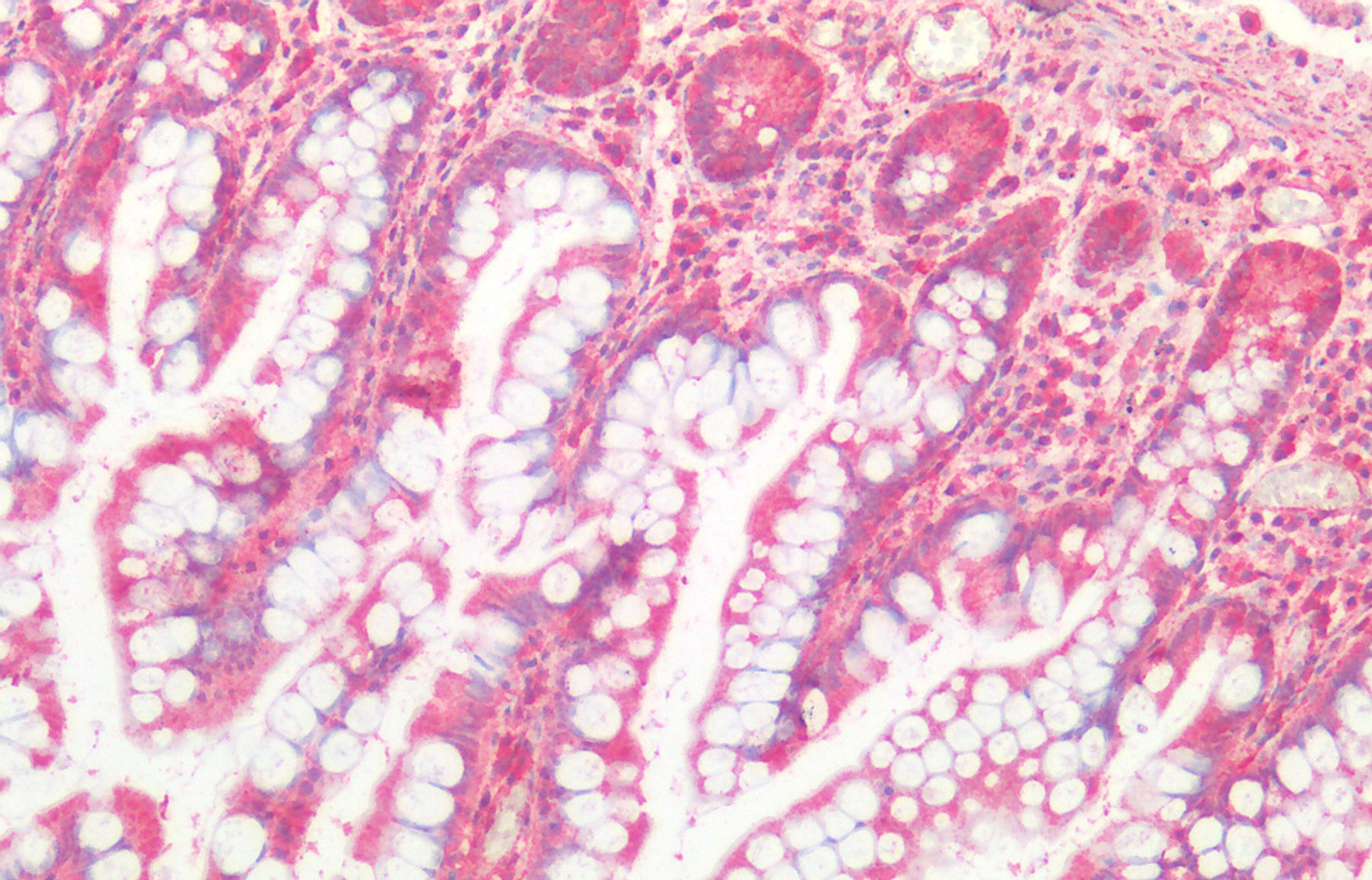 Goat anti-Cathepsin B Antibody
