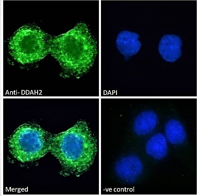 DDAH2 Antibody