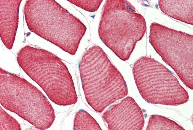 TNNT1 Antibody