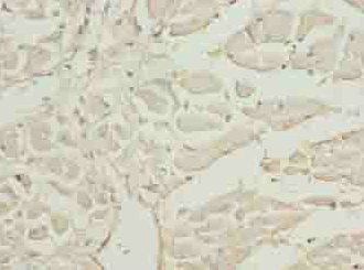 CAP2 Antibody