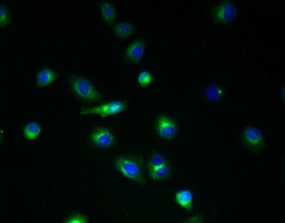 TMEM45A Antibody
