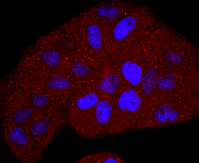 Thymidine Kinase 1 Antibody