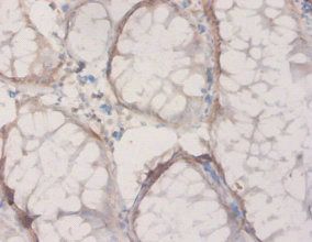 HPD Antibody