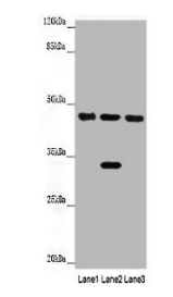 4-hydroxyphenylpyruvate dioxygenase antibody