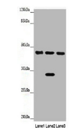 HPD Antibody