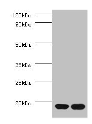 40S ribosomal protein S13 antibody