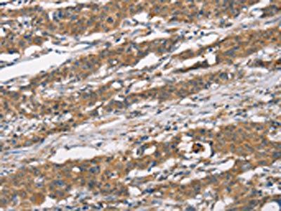 MARC1 Antibody