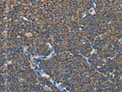SEPT9 Antibody