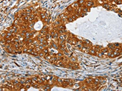 SEPT9 Antibody