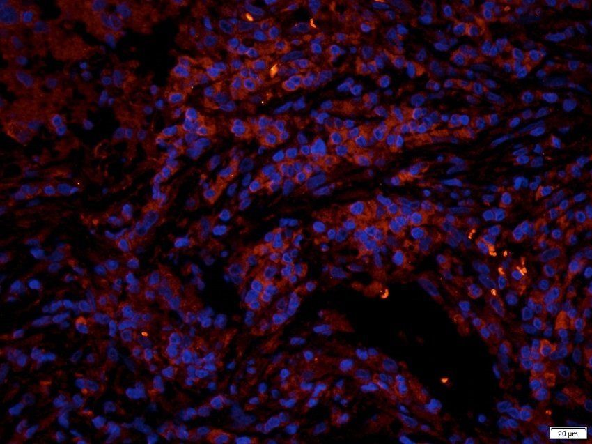 GGT1 (Isoform 1-7) antibody