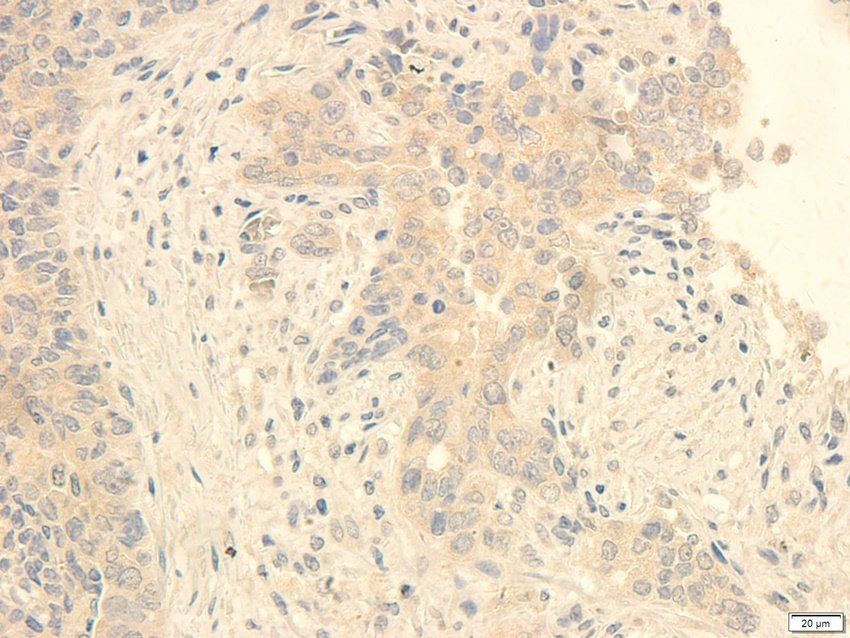 TACD2 antibody