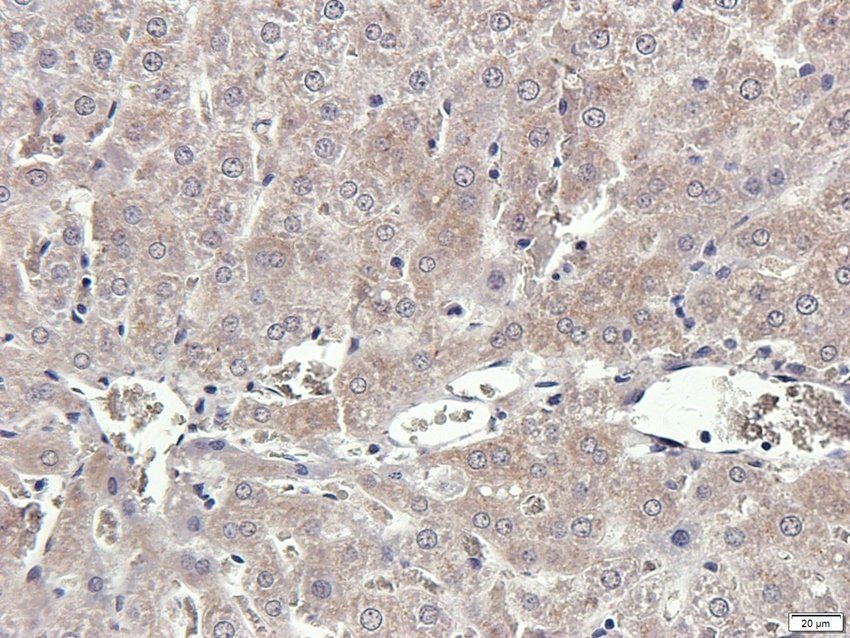 TACD2 antibody