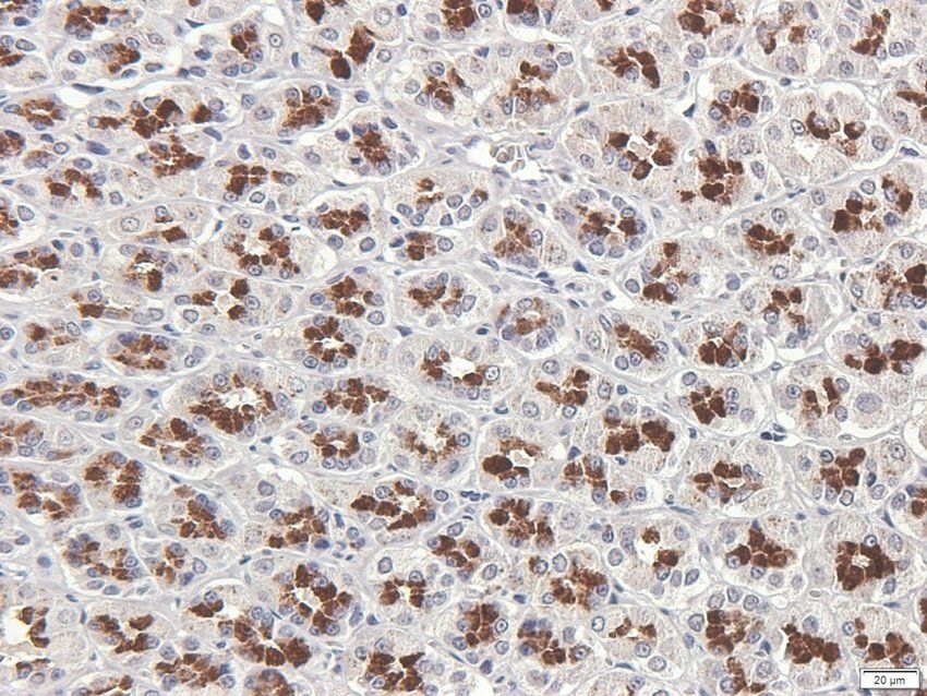 TACD2 antibody