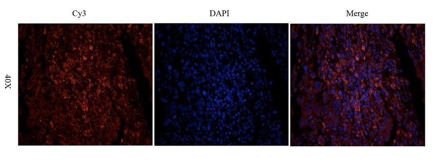 ATRX antibody