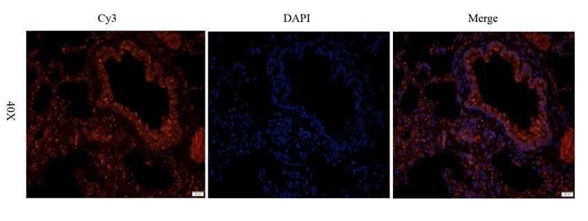 P2Y2 antibody