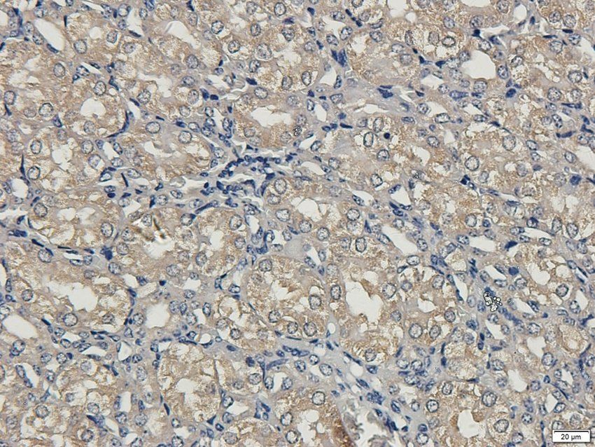 SCG2 antibody