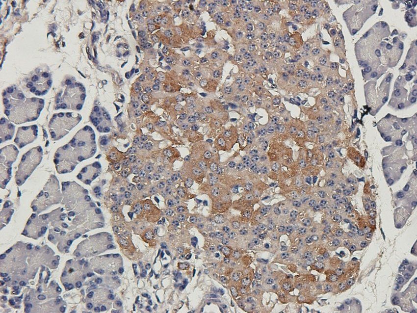 SCG2 antibody