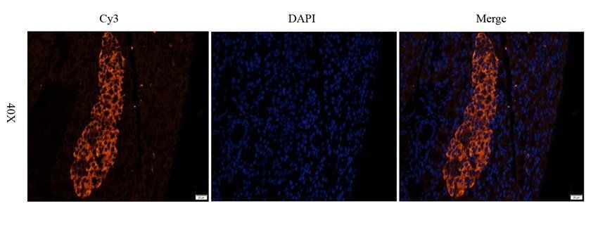 SCG2 antibody