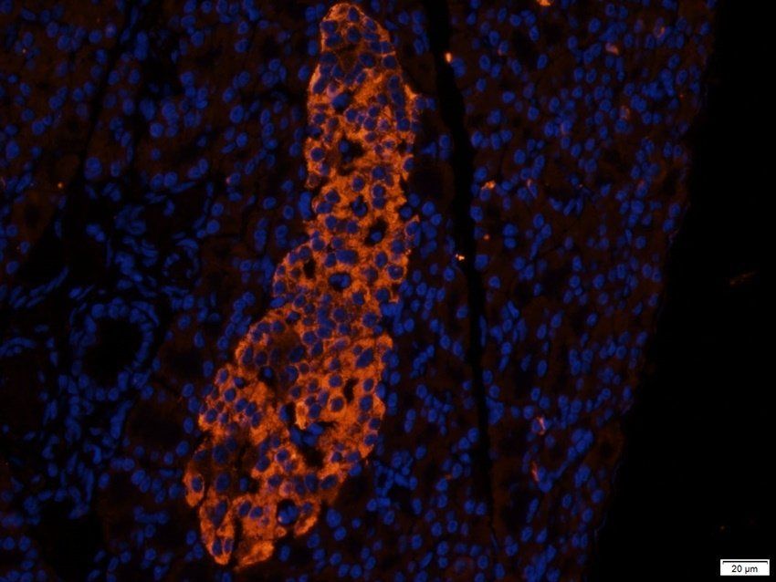 SCG2 antibody