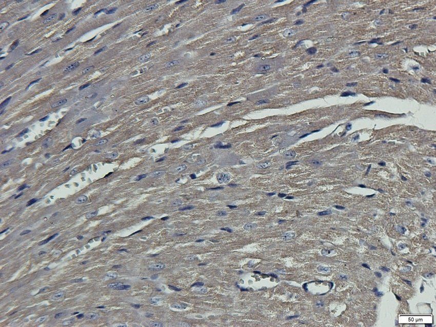 TFCP2 antibody