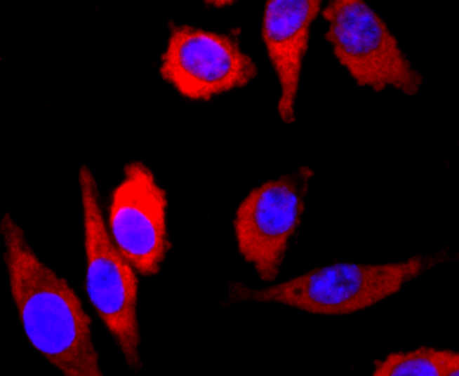 Parkin Antibody