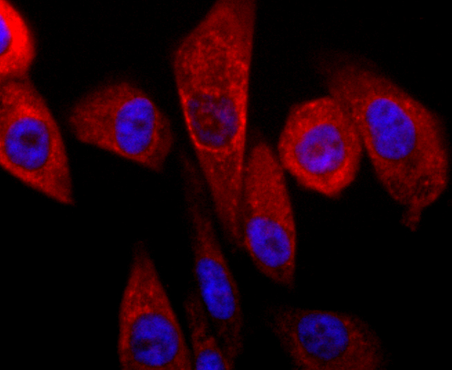 Parkin Antibody