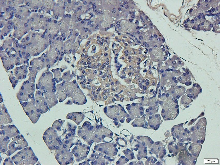 TYRP1 antibody