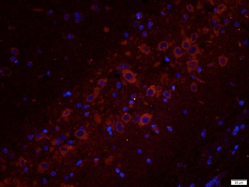 TYRP1 antibody