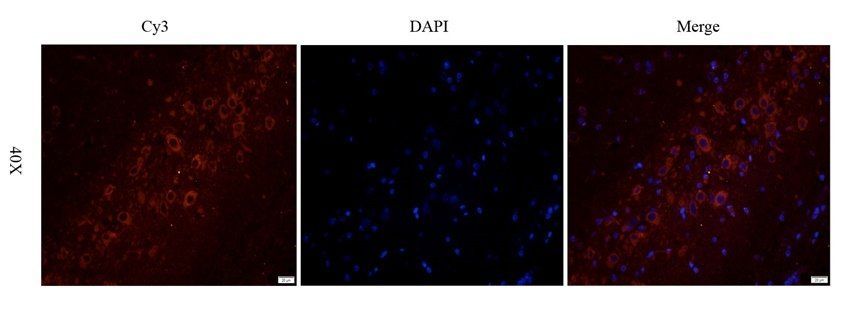 TYRP1 antibody