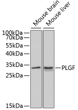 PGF Rabbit Polyclonal Antibody
