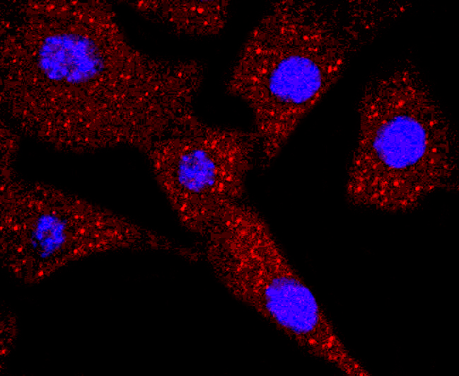 Thymidine Kinase 1 Antibody