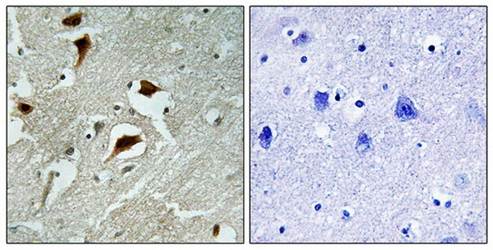 4E-BP1 (Phospho-Thr69) Antibody