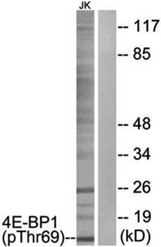 4E-BP1 (Phospho-Thr69) Antibody