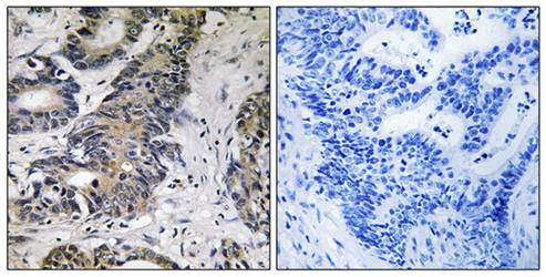 4E-BP1 (Ab-70) Antibody