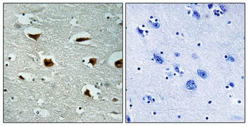 4E-BP1 (Ab-69) Antibody