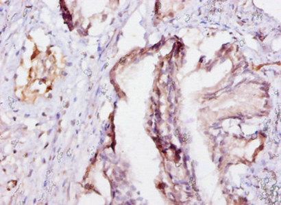 EIF4EBP2 Antibody