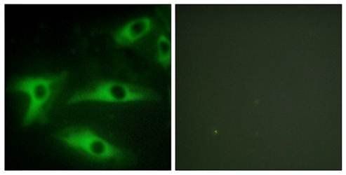 Collagen I α2 Antibody