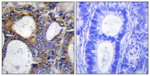 Collagen I α2 Antibody
