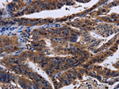 HTR2B Antibody