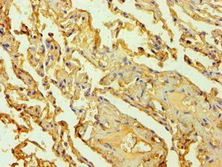 HTR2B Antibody