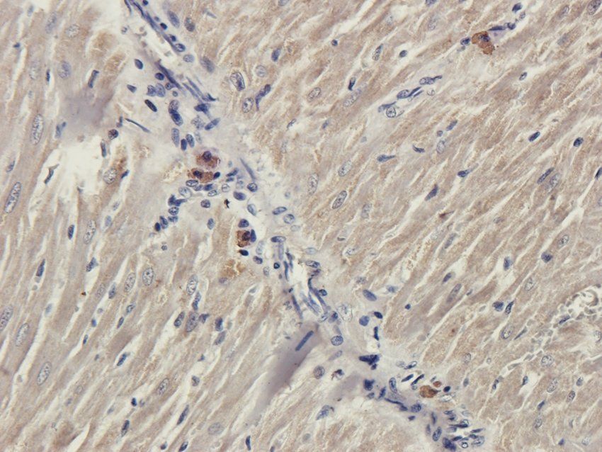 5-OxoETE antibody