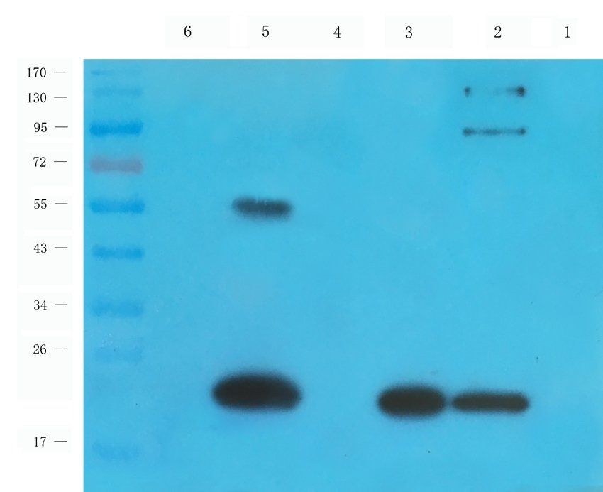 5-OxoETE antibody